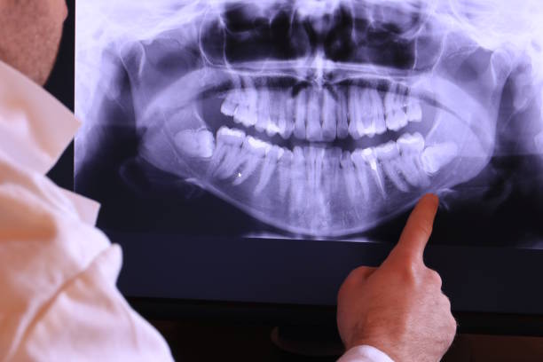 Best Emergency Tooth Extraction  in East Flat Rock, NC